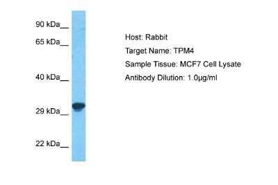 Western Blot: tropomyosin-4 Antibody [NBP2-86873] - Host: Rabbit. Target Name: TPM4. Sample Type: MCF7 Whole Cell lysates. Antibody Dilution: 1.0ug/ml