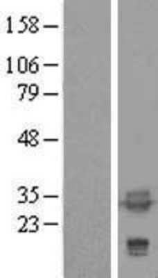 Western Blot: tropomyosin-4 Overexpression Lysate (Adult Normal) [NBL1-17221] Left-Empty vector transfected control cell lysate (HEK293 cell lysate); Right -Over-expression Lysate for tropomyosin-4.