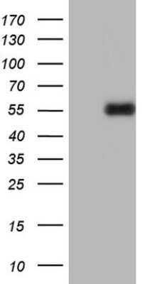 Western Blot: u-Plasminogen Activator/Urokinase Antibody (OTI5H4) - Azide and BSA Free [NBP2-74793] - Analysis of HEK293T cells were transfected with the pCMV6-ENTRY control (Left lane) or pCMV6-ENTRY u-Plasminogen Activator.