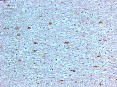 Immunohistochemistry-Paraffin: uNOS Antibody [NBP2-42208] - Human brain in multiple sclerosis lesion. Image from verified customer review.