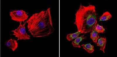 Immunocytochemistry/Immunofluorescence: uNOS Antibody (NOS-3F7-B11 B5) [NB120-2801] - Formalin-fixed cells were permeabilized with 0.1% Triton X-100 in TBS for 5-10 minutes at room temperature and blocked with 3% BSA-PBS for 30 minutes at room temperature. Cells were probed with a uNOS monoclonal antibody at a dilution of 1:20 and incubated overnight in a humidified chamber. Cells were washed with PBST and incubated with a DyLight-conjugated secondary antibody for 45 minutes at room temperature in the dark. F-actin (red) was stained with a fluorescent phalloidin and nuclei (blue) were stained with DAPI.