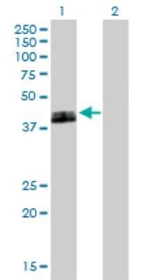 Western Blot: uPAR Antibody [H00005329-B01P] - Analysis of PLAUR expression in transfected 293T cell line by PLAUR polyclonal antibody.  Lane 1: PLAUR transfected lysate(36.85 KDa). Lane 2: Non-transfected lysate.
