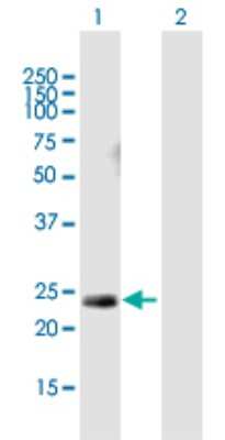 Western Blot: vH RAS Antibody [H00003265-B01P] - Analysis of HRAS expression in transfected 293T cell line by HRAS polyclonal antibody.  Lane 1: HRAS transfected lysate(20.79 KDa). Lane 2: Non-transfected lysate.
