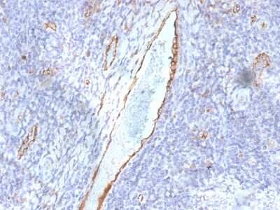Immunohistochemistry-Paraffin: vWF-A2 Antibody (F8/86) [NBP2-54379] - Formalin-fixed, paraffin-embedded human Tonsil stained with vWF Monoclonal Antibody (F8/86)