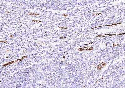 Immunohistochemistry-Paraffin: vWF-A2 Antibody [NBP3-06544] - Staining of human VWF in human tonsil with rabbit polyclonal antibody at 1:1000 dilution.