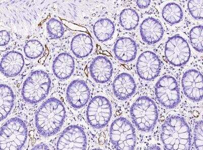 Immunohistochemistry-Paraffin: vWF-A2 Antibody [NBP3-06544] - Staining of human VWF in human colon with rabbit polyclonal antibody at 1:1000 dilution.