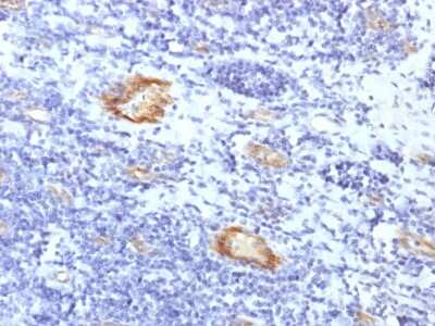Immunohistochemistry-Paraffin: vWF-A2 Antibody (VWF/1859R) - Azide and BSA Free [NBP3-08963] - Formalin-fixed, paraffin-embedded human Tonsil stained with vWF-A2 Rabbit Recombinant Monoclonal Antibody (VWF/1859R).