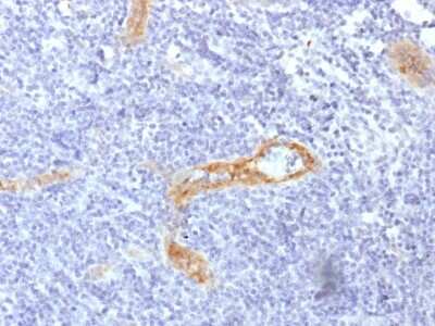 Immunohistochemistry-Paraffin: vWF-A2 Antibody (rVWF/1465) - Azide and BSA Free [NBP3-08962] - Formalin-fixed, paraffin-embedded human Tonsil stained with vWF-A2 Recombinant Mouse Monoclonal Antibody (rVWF/1465).