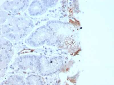 Immunohistochemistry-Paraffin: vWF-A2 Antibody (rVWF/2480) - Azide and BSA Free [NBP3-08944] - Formalin-fixed, paraffin-embedded human Tonsil stained with vWF-A2 Recombinant Mouse Monoclonal Antibody (rVWF/2480).