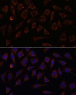 Immunocytochemistry/ Immunofluorescence villin-like Antibody - Azide and BSA Free