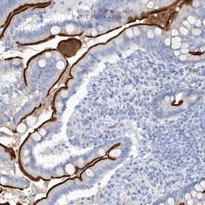 <b>Orthogonal Strategies Validation. </b>Immunohistochemistry-Paraffin: villin-like Antibody [NBP1-87514] - Staining of human small intestine shows high expression.