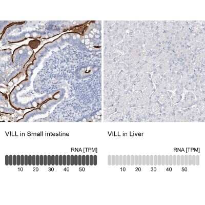 Immunohistochemistry-Paraffin: villin-like Antibody [NBP1-87514] - Staining in human small intestine and liver tissues using anti-VILL antibody. Corresponding VILL RNA-seq data are presented for the same tissues.