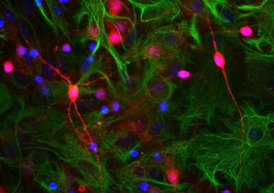 Immunocytochemistry/Immunofluorescence: visinin-like 1 Antibody [NBP2-25169] - Neuron-glia cell culture stained with NBP2-25169 (red), monoclonal antibody to GFAP: NBP1-05197 (green) and DNA (blue). NBP2-25169 reveals strong staining throughout some small neurons in soma and all processes, accumulation is seen in some hotspots along neurites. GFAP appears only in astrocytes.