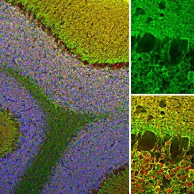 Immunohistochemistry Free-Floating: visinin-like 1 Antibody [NBP2-25169] - Analysis of rat cerebellum section stained with rabbit pAb to VLP1, NBP2-25169, dilution 1:2,000 in green, and costained with mouse mAb to calretinin, dilution 1:2,000 in red. The blue is DAPI staining of nuclear DNA. Following transcardial perfusion of rat with 4% paraformaldehyde, brain was post fixed for 24 hours, cut to 45uM, and free-floating sections were stained with the above antibodies. The VLP1 antibody reveals protein expressed in granule cells membranes and their synapses in both the granular and molecular layer of the cerebellum. The calretinin antibody stains the cytoplasm of neurons in the nuclear and molecular layers of cerebellum.