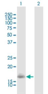 Western Blot: visinin-like 1 Antibody [H00007447-B01P] - Analysis of VSNL1 expression in transfected 293T cell line by VSNL1 polyclonal antibody.  Lane 1: VSNL1 transfected lysate(22.10 KDa). Lane 2: Non-transfected lysate.