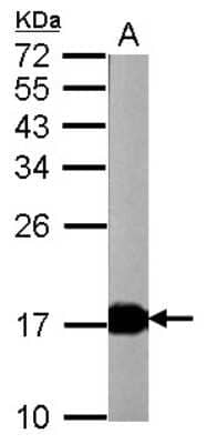 Western Blot: visinin-like 1 Antibody [NBP2-20862] - Sample (20 ug of whole cell lysate) A: mouse brain 12% SDS PAGE gel, diluted at 1:20000.