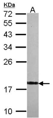 Western Blot: visinin-like 1 Antibody [NBP2-20862] - Sample (30 ug of whole cell lysate) A: IMR32 12% SDS PAGE gel, diluted at 1:1000.