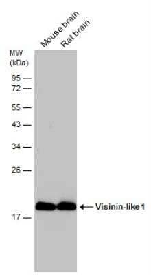 Western Blot: visinin-like 1 Antibody [NBP2-20862] - Various tissue extracts (50 ug) were separated by 12% SDS-PAGE, and the membrane was blotted with Visinin-like 1 antibody diluted at 1:100000.