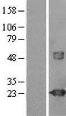Western Blot: visinin-like 1 Overexpression Lysate (Adult Normal) [NBL1-17764] Left-Empty vector transfected control cell lysate (HEK293 cell lysate); Right -Over-expression Lysate for visinin-like 1.