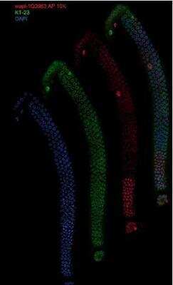Immunocytochemistry/Immunofluorescence: wapl-1 Antibody [49300002] - This image is specific to animal number SDQ3963