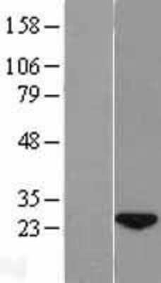 Western Blot: wdyhv1 Overexpression Lysate (Adult Normal) [NBL1-08565] Left-Empty vector transfected control cell lysate (HEK293 cell lysate); Right -Over-expression Lysate for wdyhv1.