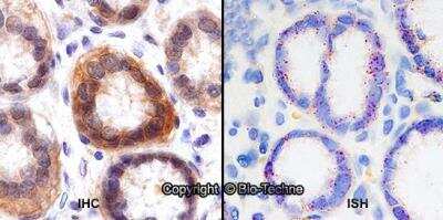 Dual RNAscope ISH-IHC: xCT Antibody Pack [NB100-937] - Formalin-fixed paraffin-embedded tissue sections of human stomach were probed for xCT mRNA (ACD RNAScope Probe, catalog #422688; Fast Red chromogen, ACD catalog # 322750). Adjacent tissue section was processed for immunohistochemistry using Rabbit Polyclonal (Novus Biologicals catalog # NB300-318) at 0.25ug/mL with 1 hour incubation at room temperature followed by incubation with anti-rabbit IgG VisUCyte HRP Polymer Antibody (Catalog # VC003) and DAB chromogen (yellow-brown). Tissue was counterstained with hematoxylin (blue). Specific staining was localized to glandular cells.