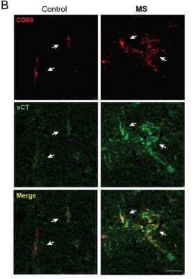 Immunohistochemistry: xCT Antibody Pack [NB100-937] - xCT expression is enhanced in CD68+ cells from MS spinal cord. CD68+ cells (arrows) show enhanced xCT expression in MS patients as compared to controls. CD68+ macrophages are round shaped and form clusters in MS patients, whereas in controls, CD68+ cells appear isolated and long shaped. Scale bar = 50 um. Image collected and cropped by CiteAb from the following publication (//jneuroinflammation.biomedcentral.com/articles/10.1186/1742-2094-8-63), licensed under a CC-BY license. xCT Antibody [NB300-317]