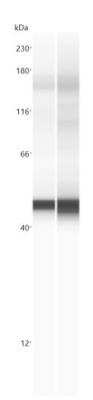 Simple Western: xCT Antibody Pack [NB100-937] - Simple Western lane view shows a specific band for xCT using NB300-318 at 25 ug/ml in HeLa and HeLa + DEM cell lysates. This experiment was performed under reducing conditions using the 12-230 kDa separation system. xCT Antibody [NB300-318]