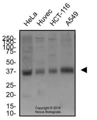 Western Blot: xCT Antibody Pack [NB100-937] - Total protein from human HeLa, Huvec, HCT-116 and A549 cells was separated on a 12% gel by SDS-PAGE, transferred to PVDF membrane and blocked in 5% non-fat milk in TBST. The membrane was probed with 2.0 ug/ml anti-xCT in block buffer and detected with an anti-rabbit HRP secondary antibody using chemiluminescence. xCT Antibody [NB300-317]