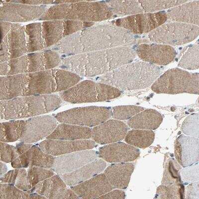 Immunohistochemistry-Paraffin xylosyltransferase 1 Antibody