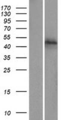Western Blot: zfp-1 Overexpression Lysate (Adult Normal) [NBP2-05220] Left-Empty vector transfected control cell lysate (HEK293 cell lysate); Right -Over-expression Lysate for zfp-1.