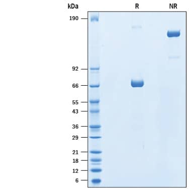 2 μg/lane of Recombinant Human KIR3DL3/CD158z Fc Chimera (Catalog # 10104-KR) was resolved with SDS-PAGE under reducing (R) and non-reducing (NR) conditions and visualized by Coomassie® Blue staining, showing bands at 62-71 kDa and 120-140 kDa.