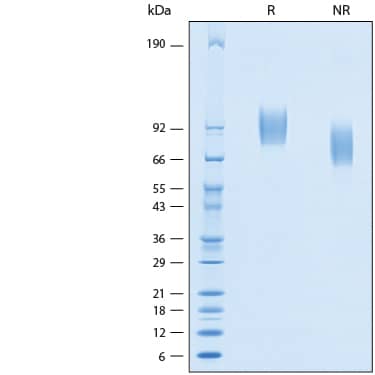 2 μg/lane of Recombinant Human PDGF R alpha His-tag Protein (Catalog # 10383-PR) was resolved with SDS-PAGE under reducing (R) and non-reducing (NR) conditions and visualized by Coomassie® Blue staining, showing bands at 89-100 kDa.