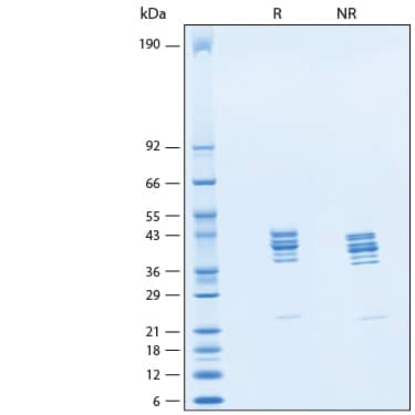 SDS-PAGE ST3GAL3 [Unconjugated]