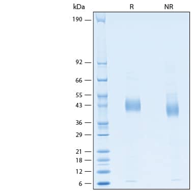 2 μg/lane of Recombinant Human B3GalT5 His-tag Protein (Catalog # 10555-GT) was resolved with SDS-PAGE under reducing (R) and non-reducing (NR) conditions and visualized by Coomassie® Blue staining, showing bands at 40-45 kDa.