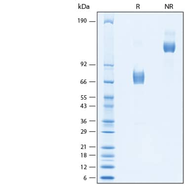 2 μg/lane of Recombinant Human ST3GAL6 Fc Chimera Protein (Catalog # 10591-GT) was resolved with SDS-PAGE under reducing (R) and non-reducing (NR) conditions and visualized by Coomassie® Blue staining, showing bands at 67-81 kDa.