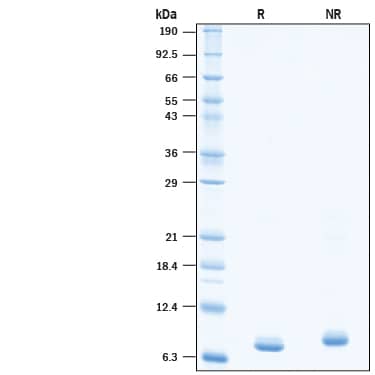 2 μg/lane of Recombinant SARS-CoV-2 NSP7 His-tag (Catalog # 10632-CV) was resolved with SDS-PAGE under reducing (R) and non-reducing (NR) conditions and visualized by Coomassie® Blue staining, showing bands at 7-8 kDa under reducing conditions.