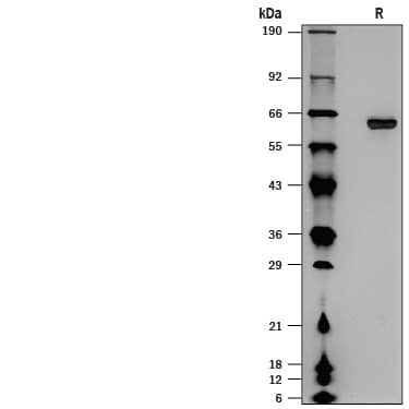1 μg/lane of Recombinant Human MAN1A1 His-tag (Catalog # 10665-GT) was resolved with SDS-PAGE under reducing (R) conditions and visualized by silver staining, showing a band at  63-65 kDa.