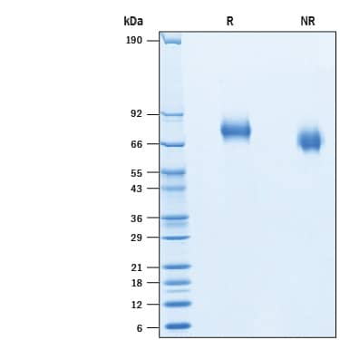 2 μg/lane of Recombinant Human Netrin-G2 His-tag (Catalog # 10675-NG) was resolved with SDS-PAGE under reducing (R) and non-reducing (NR) conditions and visualized by Coomassie® Blue staining, showing bands at 70-78 kDa.