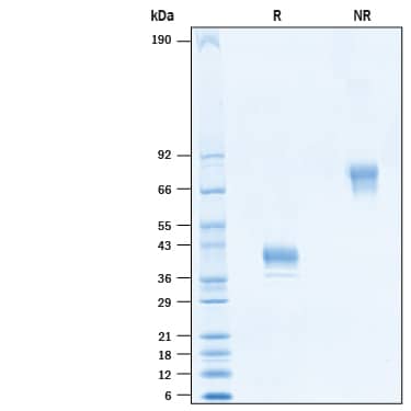 2 μg/lane of Recombinant SARS-CoV-2 Membrane Fc Chimera Protein (Catalog # 10690-CV) was resolved with SDS-PAGE under reducing (R) and non-reducing (NR) conditions. Visualized by Coomassie® Blue staining, showing bands at 33-43 kDa and 60-80 kDa, respectively.