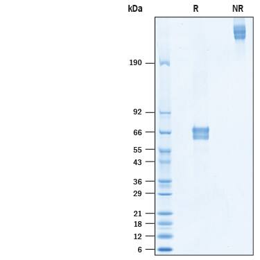 2 μg/lane of Recombinant Mouse FGL2 HA-tag (Catalog # 10691-FL) was resolved with SDS-PAGE under reducing (R) and non-reducing (NR) conditions and visualized by Coomassie® Blue staining, showing bands at 61-72 kDa and 244-288 kDa, respectively.