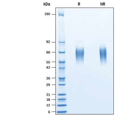 2 μg/lane of Recombinant Mouse ST2/IL-33R His-tag (Catalog # 10695-MR) was resolved with SDS-PAGE under reducing (R) and non-reducing (NR) conditions and visualized by Coomassie® Blue staining, showing bands at 57-68 kDa.