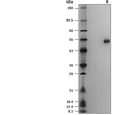 1 μg/lane of Recombinant Human MGAT2 His-tag (Catalog # 10711-GT) was resolved with SDS-PAGE under reducing (R) conditions and visualized by silver staining, showing bands at 46-54 kDa.