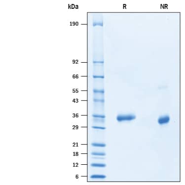 2 μg/lane of Recombinant SARS-CoV-2 S477N Spike RBD His-tag (Catalog # 10713-CV) was resolved with SDS-PAGE under reducing (R) and non-reducing (NR) conditions and visualized by Coomassie® Blue staining, showing bands at 33-38 kDa.