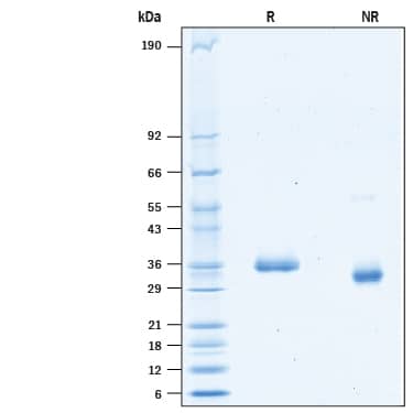 2 μg/lane of Recombinant SARS-CoV-2 N439K Spike RBD His-tag (Catalog # 10714-CV) was resolved with SDS-PAGE under reducing (R) and non-reducing (NR) conditions and visualized by Coomassie® Blue staining, showing bands at 33-38 kDa.