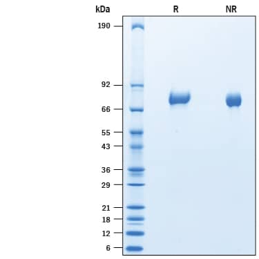 2 μg/lane of Recombinant Mouse FLRT2 His-tag (Catalog # 10715-FL) was resolved with SDS-PAGE under reducing (R) and non-reducing (NR) conditions and visualized by Coomassie® Blue staining, showing bands at 71-80 kDa.