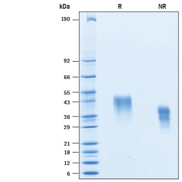 2 μg/lane of Recombinant Cynomolgus Monkey CD25/IL-2R alpha His-tag (Catalog # 10716-CV) was resolved with SDS-PAGE under reducing (R) and non-reducing (NR) conditions and visualized by Coomassie® Blue staining, showing bands at 40-45  kDa and 35- 40 kDa, repsectively.