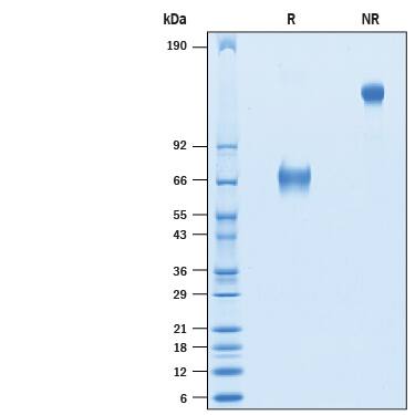 2 μg/lane of Recombinant Cynomolgus Monkey CD25/IL-2R alpha Fc Chimera (Catalog # 10721-RL) was resolved with SDS-PAGE under reducing (R) and non-reducing (NR) conditions and visualized by Coomassie® Blue staining, showing bands at 64-73 kDa and 128-146 kDa, respectively.