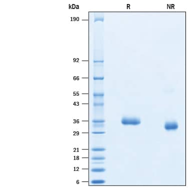 2 μg/lane of Recombinant SARS-CoV-2 E484K Spike RBD His-tag (Catalog # 10747-CV) was resolved with SDS-PAGE under reducing (R) and non-reducing (NR) conditions and visualized by Coomassie® Blue staining, showing bands at 30-40 kDa.