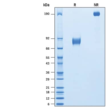 2 μg/lane of Recombinant Mouse IL1RAPL1 Fc Chimera (Catalog # 10756-MR) was resolved with SDS-PAGE under reducing (R) and non-reducing (NR) conditions and visualized by Coomassie® Blue staining, showing bands at 78-88 kDa and 156-176 kDa, respectively.